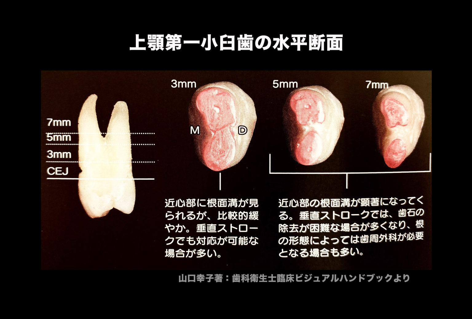一般的な歯の状態