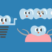 歯の抜けた顎の治療オプション