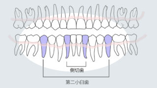 歯の欠損　ー永久歯の先天性欠如ー