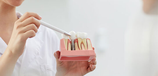 インプラント治療流れアイキャッチ画像