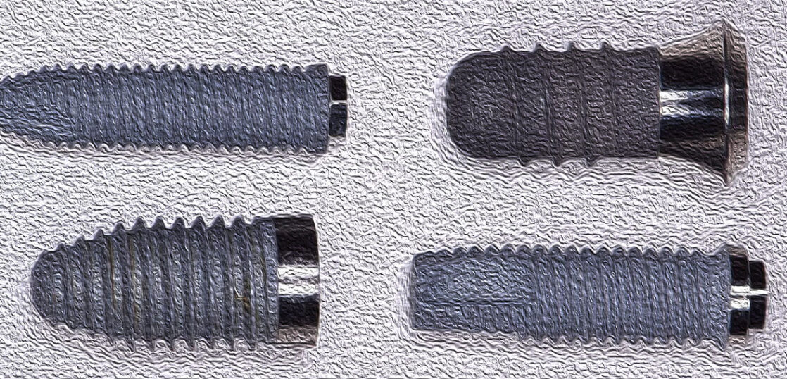 各種インプラント